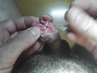 Piercing increased by subincision